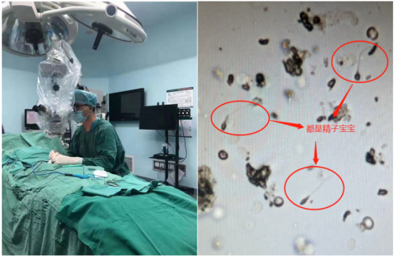 海南首例先天性无精子症患者成功生育后代
