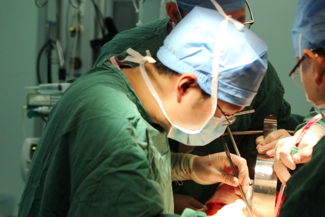 三亚市人民医院成功切除8.6斤特大肝肿瘤