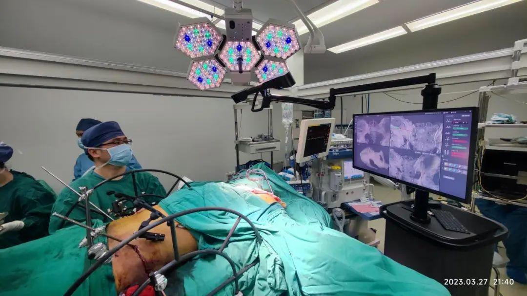 HoloSight联合UCRT技术成功完成多例高难度骨盆骨折智能可视化微创复位内固定术