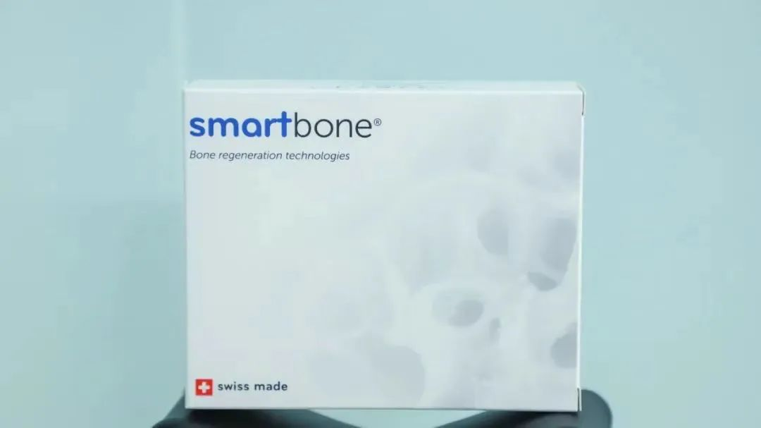 定制再生骨SmartBone® on Demand™在博鳌乐城实现国内首用