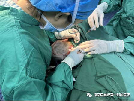 海医一附院整形美容外科成功开展首例毛发移植术