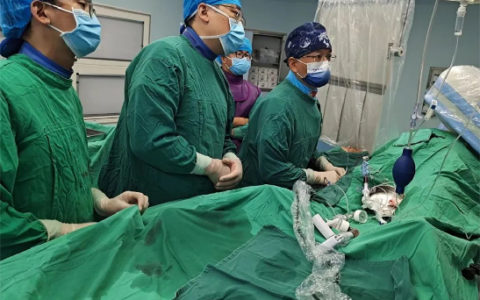 海南首例冠脉Shockwave IVL成功实施