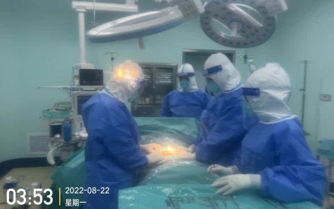 抗疫故事丨海南西部中心医院成功救治7岁急性坏疽性阑尾炎新冠患儿