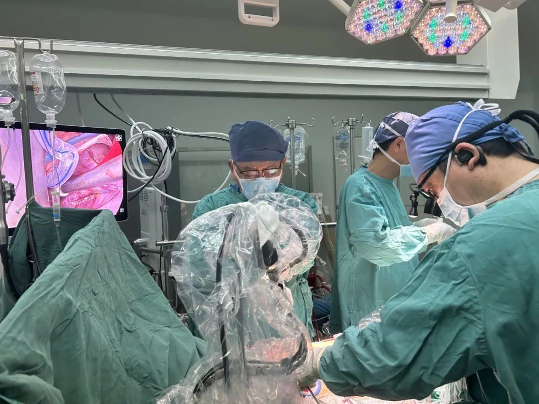 海南省人民医院完成一例胸腔镜“Cone”手术,解剖矫治先天性“Ebstein”畸形