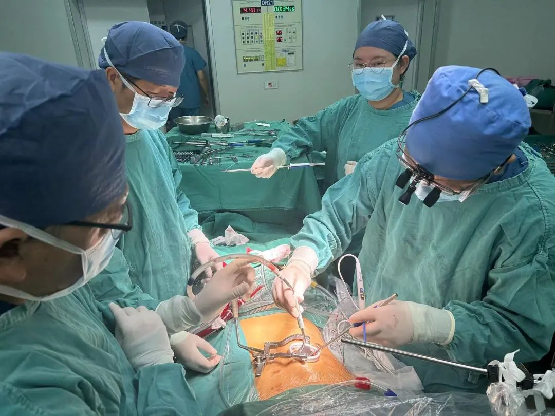 海南省人民医院完成一例胸腔镜“Cone”手术，解剖矫治先天性“Ebstein”畸形