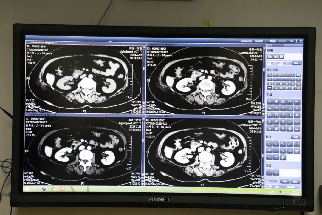 集中优势资源救治危重症患者——院领导MDT(A级)讨论会首场顺利召开