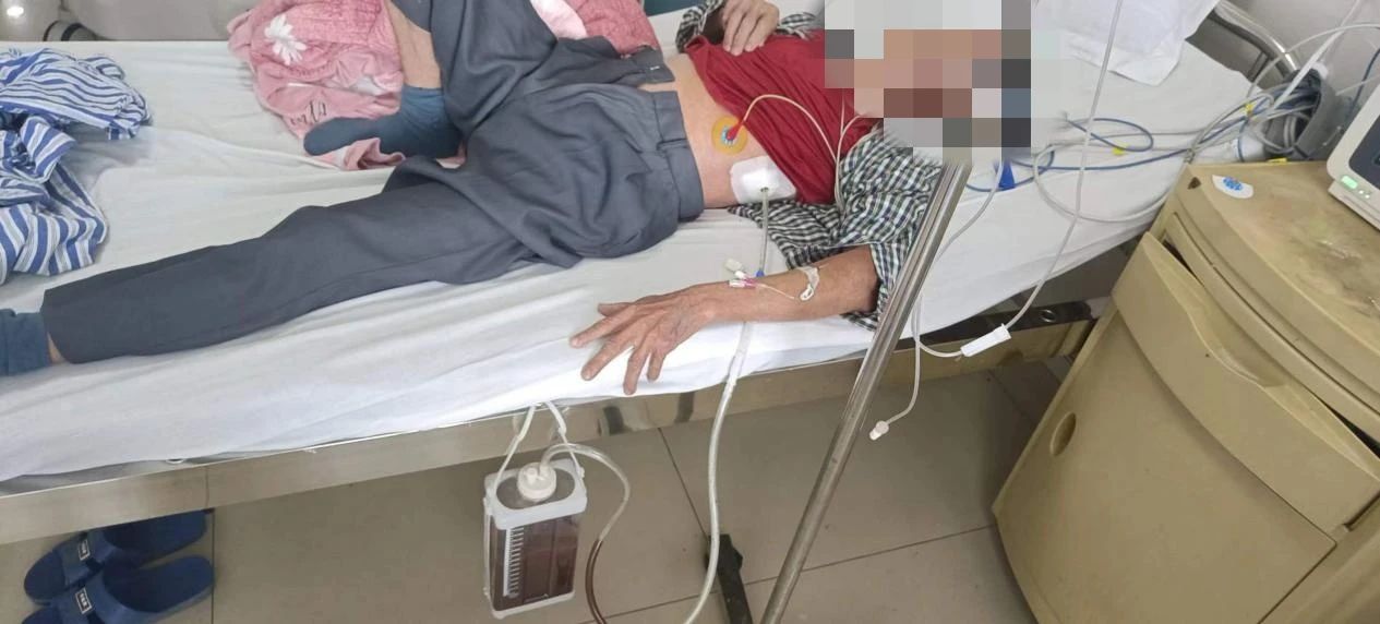 生死时速：老人过度饮酒致食管破裂，医院多科协作成功救回