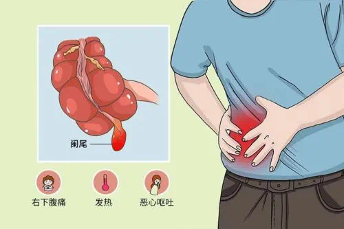 海南省人民医院消化内科成功开展首例ERAT技术