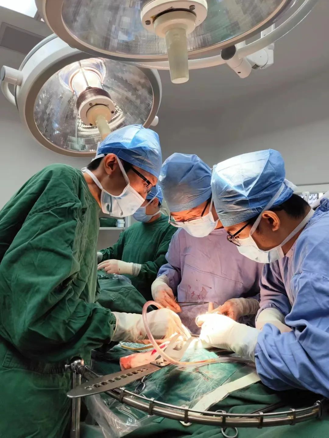 肝癌≠“死亡宣判”！60岁老人在文昌市人民医院重获新生