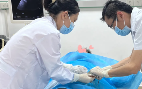 胰周积液不开刀  超声介入来引导