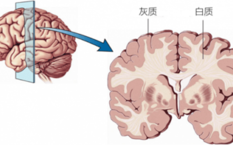 体检发现脑白质高信号怎么办？