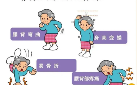 骨质疏松患者吃什么好？