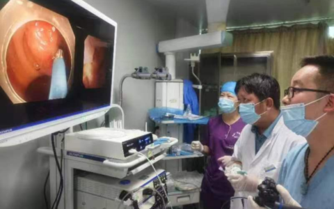 海医一附院成功实施内镜下逆行阑尾治疗术