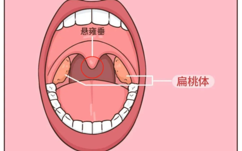 一根头发丝竟然在7月龄宝宝的喉咙打了个结...