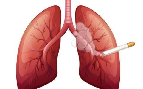 吸烟与肺癌究竟有多大关系？
