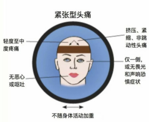 你了解紧张型头痛吗？