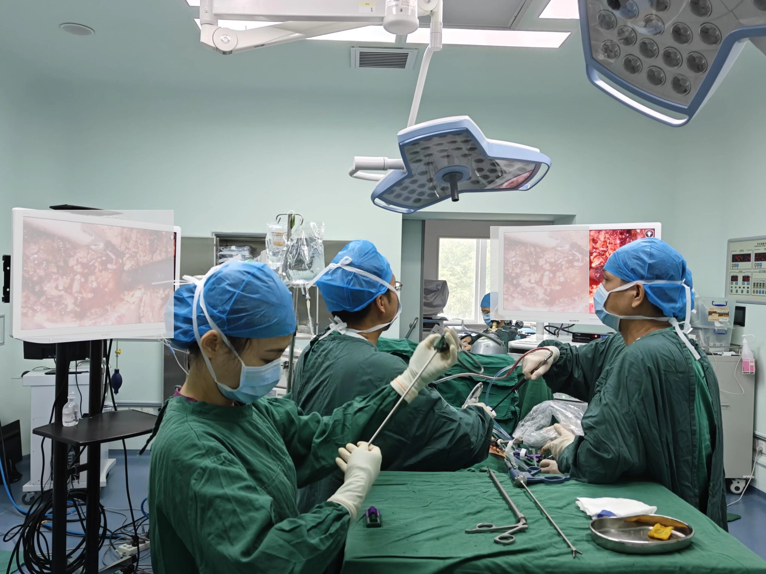 琼南首例!三亚市人民医院成功完成高难度腹腔镜下胆囊癌根治手术