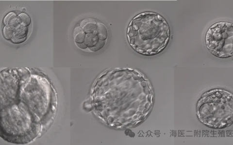 生育力保存——为肿瘤患者存下希望的种子