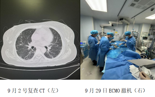 女孩心脏骤停命悬一线,海医一附院重症医学科用ECMO续写生命奇迹