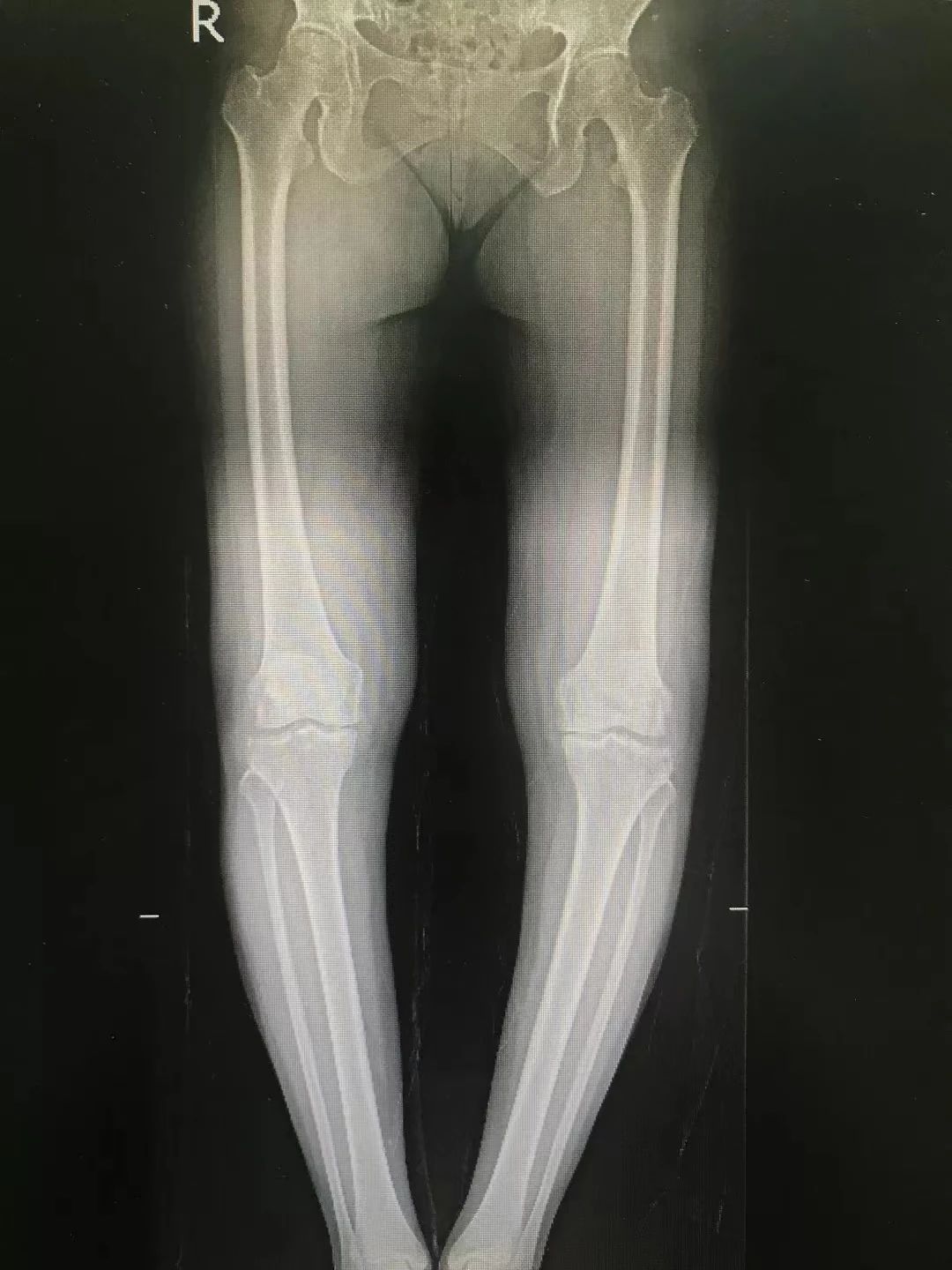 海南省人民医院骨科医学中心之运动医学科:以医学之名,赋能运动健康