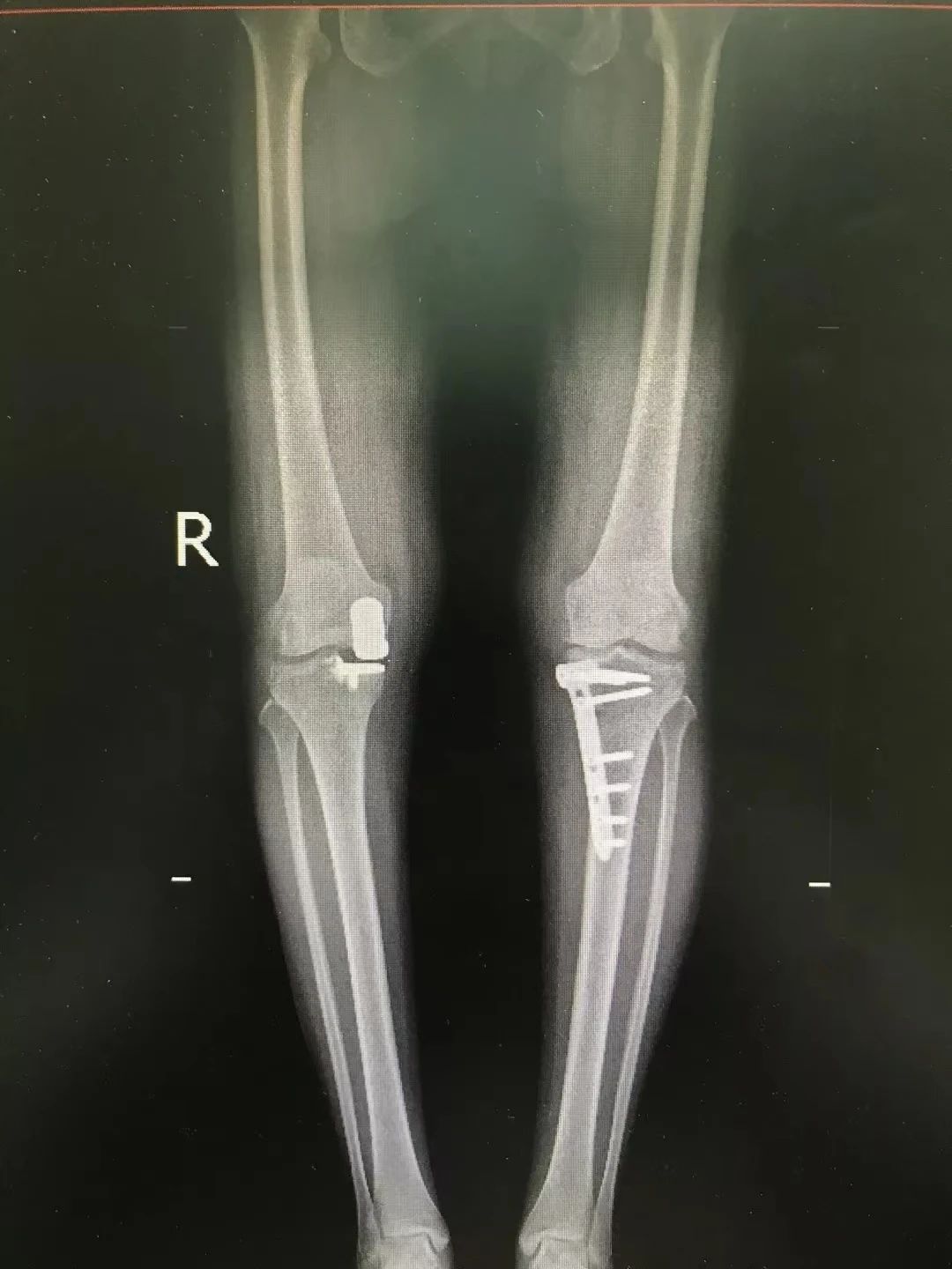 海南省人民医院骨科医学中心之运动医学科:以医学之名,赋能运动健康