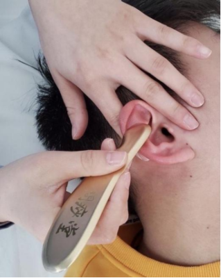 三联序贯耳疗 成为海南中医适应技术推广典范