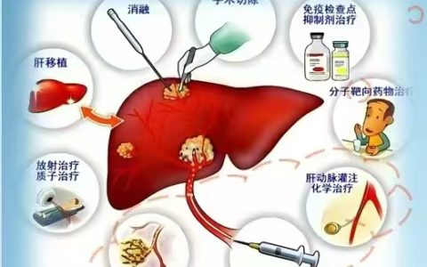 一站式就医  MDT聚力治疗复杂肝病患者——解放军总医院海南医院肝病多学科联合门诊开诊