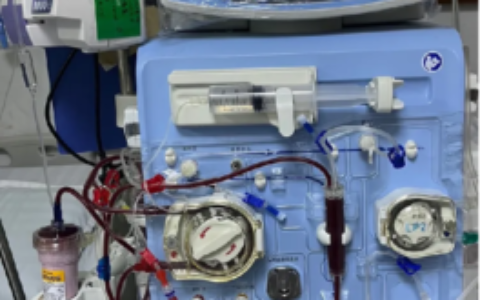 不死的癌症—重症狼疮患者重生之旅