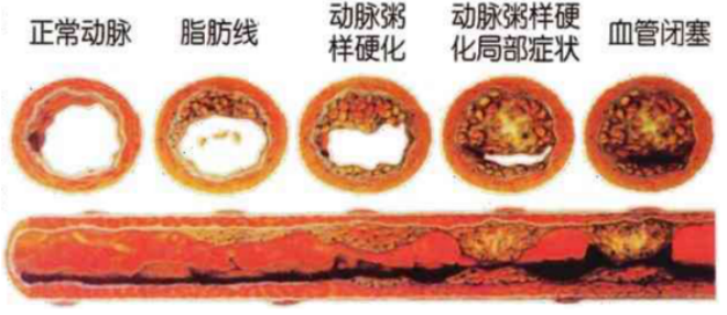 减肥新方案！用于长期体重管理的司美格鲁肽注射液在瑞金海南医院可及