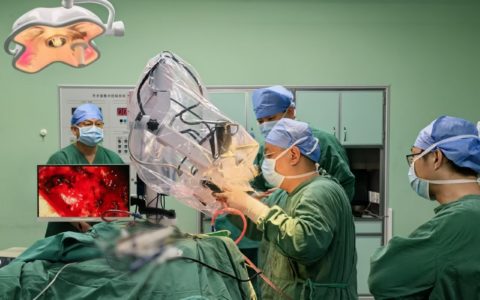 保亭县医疗集团总院成功开展两例高难度显微镜下脑膜瘤切除手术