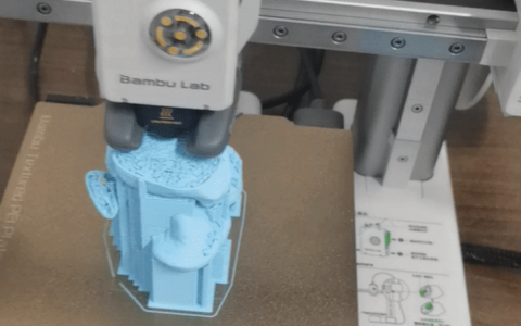 海医二院3D打印辅助骨折术前设计，让手术更精准、更安心！