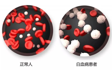 一位白血病患者的重生之路！CAR-T细胞疗法点亮治愈之光