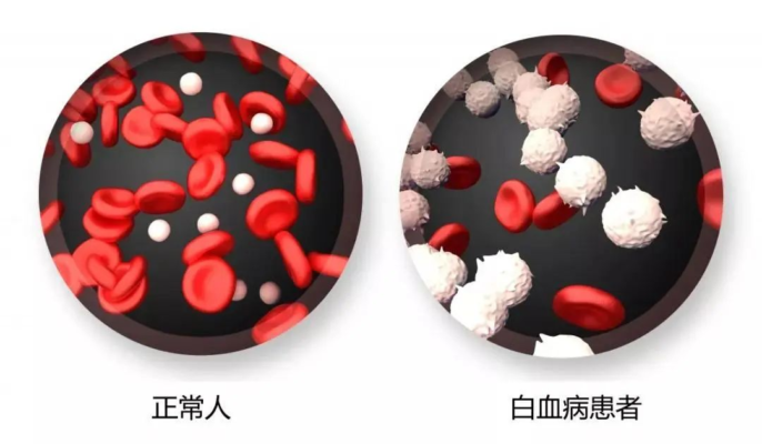 一位白血病患者的重生之路！CAR-T细胞疗法点亮治愈之光