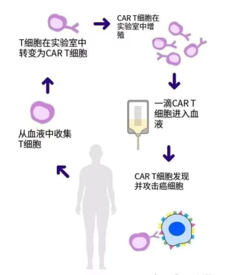 一位白血病患者的重生之路！CAR-T细胞疗法点亮治愈之光