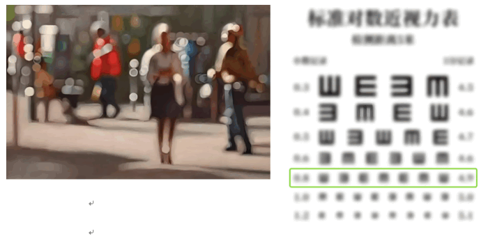 黄斑镜新术破“盲”局 海南老年患者迎“睛”喜