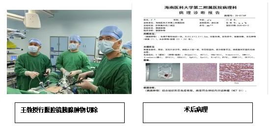 海医二院双镜联合微创手术为年轻胰腺神经内分泌肿瘤患者带来新希望
