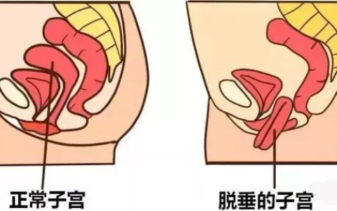 别让身体“垂头丧气” 专业干预找回健康底气