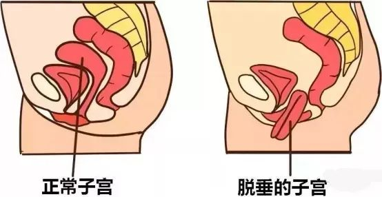 别让身体“垂头丧气” 专业干预找回健康底气