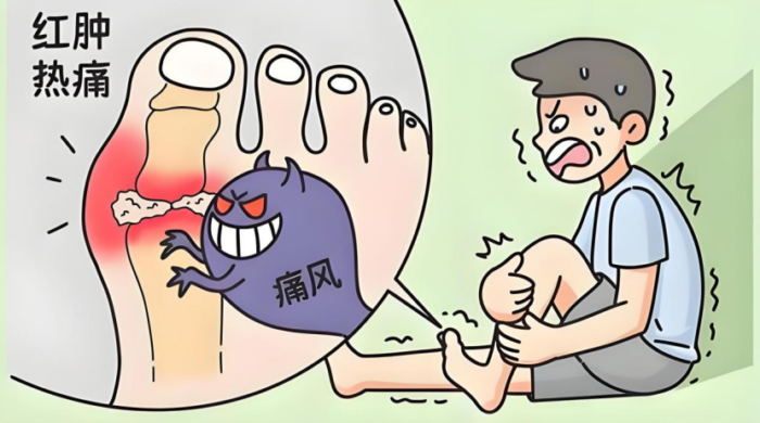当"疯狂石头"在骨缝里扎根：这个疾病正年轻化入侵