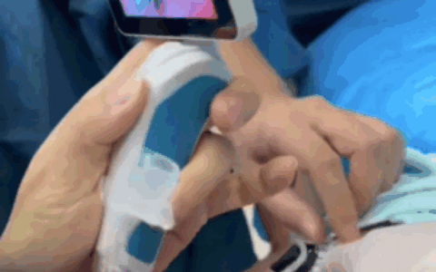 “趴睡宝宝”获救了！海南省人民医院多学科团队为2月龄宝宝重建“生命气道”