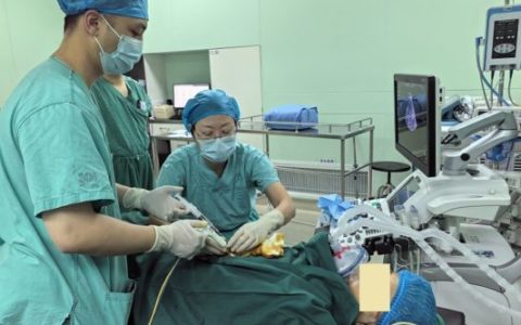 解放军总医院海南医院完成一例肝内胆管囊腺瘤囊液抽吸联合射频消融手术​