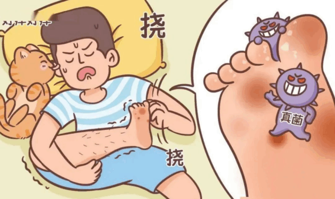 警惕！你以为的 “缺水脚跟”，实则是脚气的 “潜伏计划”