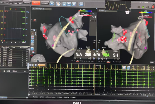 19岁小伙频遭“心”危机!这项技术成破局关键