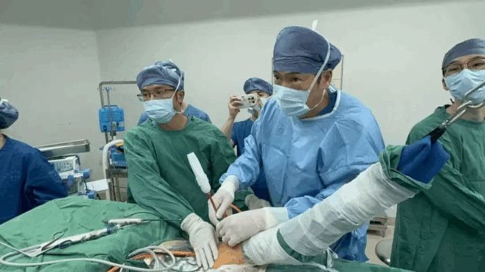 术后第二天就抬手！海南省人民医院破解高龄巨大肩袖撕裂治疗难题