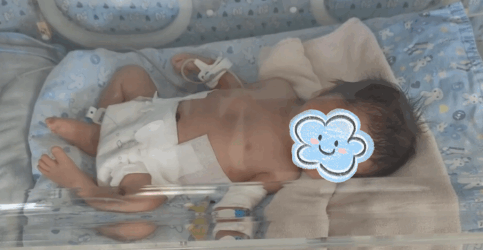孕囊长在剖宫产刀口上？凶险瘢痕妊娠，生死一线！