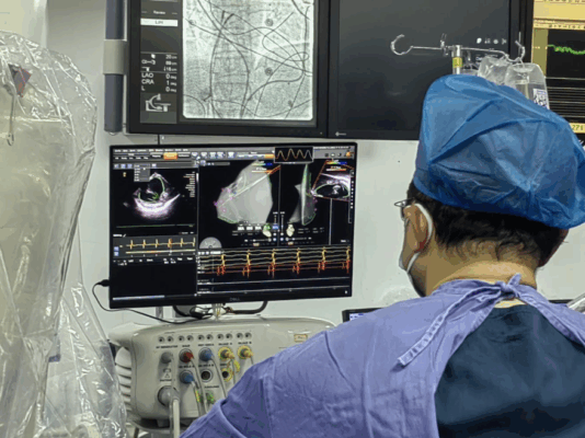 三亚中心医院心血管疾病中心二区成功实施心腔内超声(ICE)引导下射频消融术