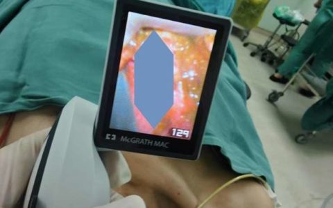 六旬老人5天未进食 军医接力“疏通”肠梗阻