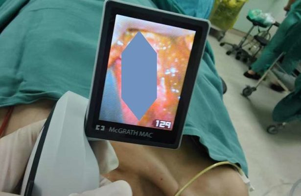 六旬老人5天未进食 军医接力“疏通”肠梗阻