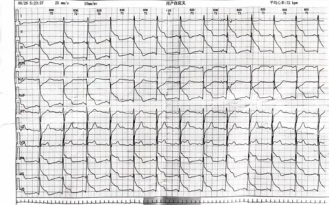 “您所拨打的电话号码是空号……”，失联心梗患者的“死里逃生”