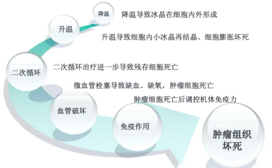 海南首例：冰火“双术”点燃生命希望，晚期肺癌消融联合免疫治疗显奇效
